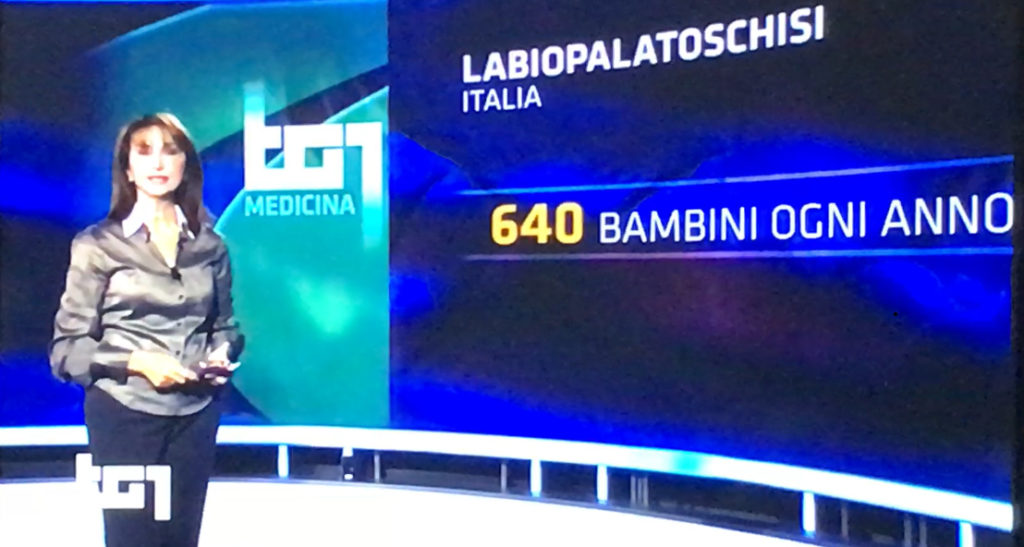 TG1 Medicina sulla cura delle Labiopalatoschisi presso l'Ospedale Bambino Gesù